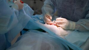 A closeup of eye surgeons performing surgery on a patient's eye