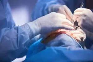 Doctors performing surgery on a patient's eye