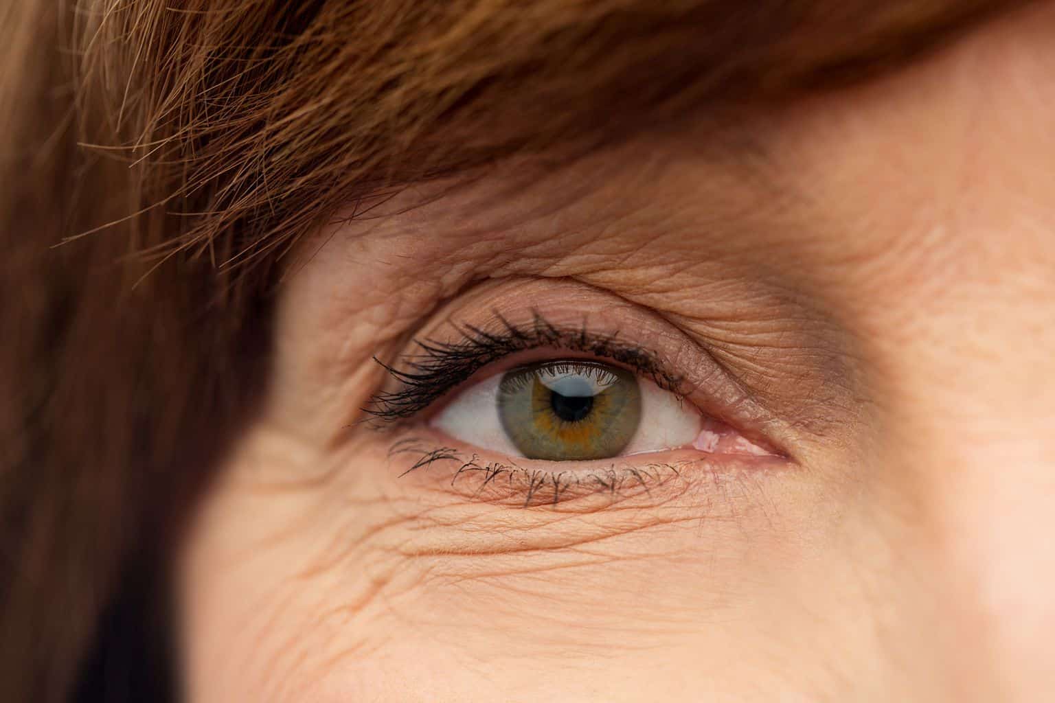 Do You Have AgeRelated Macular Degeneration? Florida Eye Specialists