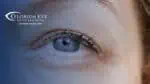photograph of a blonde women's blue eye. The image has a blue shadow overlay with the Florida Eye Specialists logo in the top left corner.