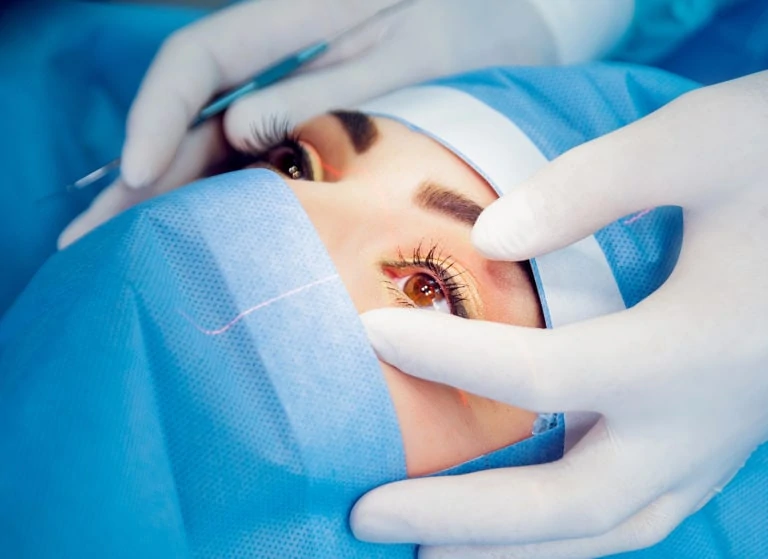 close up on brown eye ball with long eyelash ready for eye surgery